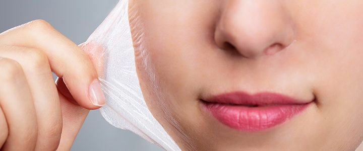 Chemical Peels for Pigmentation: Do They Really Work?