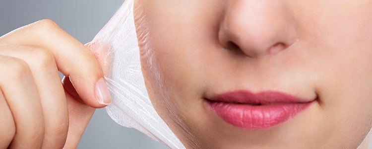 Chemical Peels for Pigmentation: Do They Really Work?